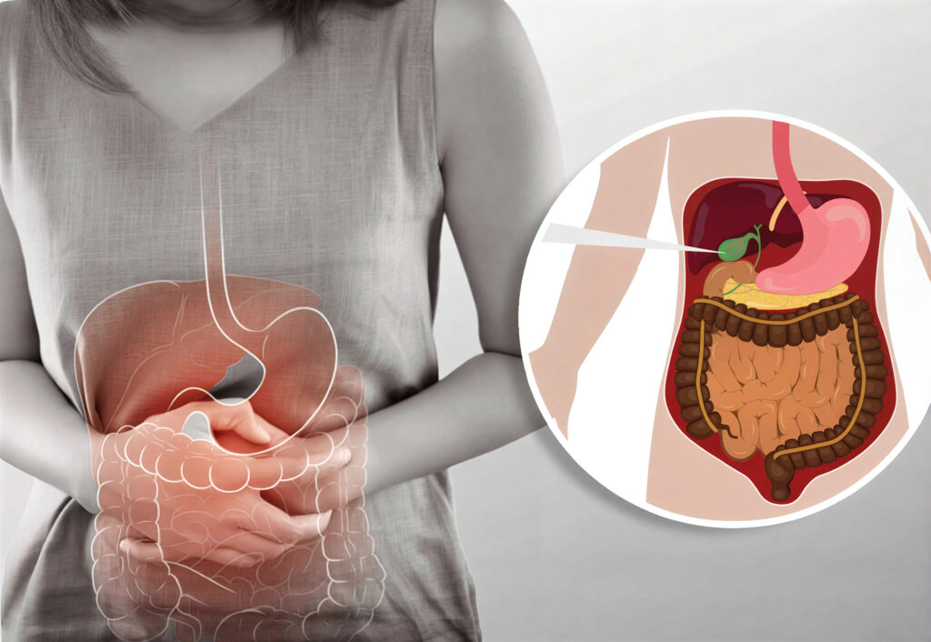 Laparoscopic Gallbladder Surgery in Pune | Kimaya Clinic – Dr. Milind Joshi